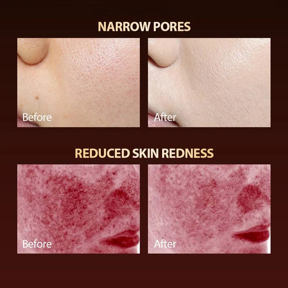 7 Colors LED Facial Mask Light Therapy Silicone Photon Beauty Mask for Lift Face anti Shrink Pore Skin Repair Whiten Oil Control